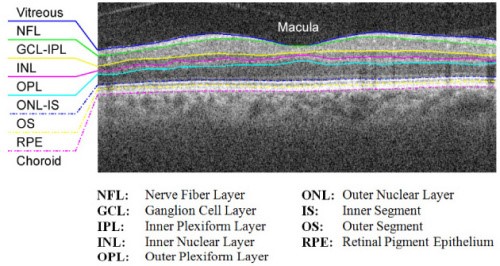 retina-image-segmentation-0.jpg
