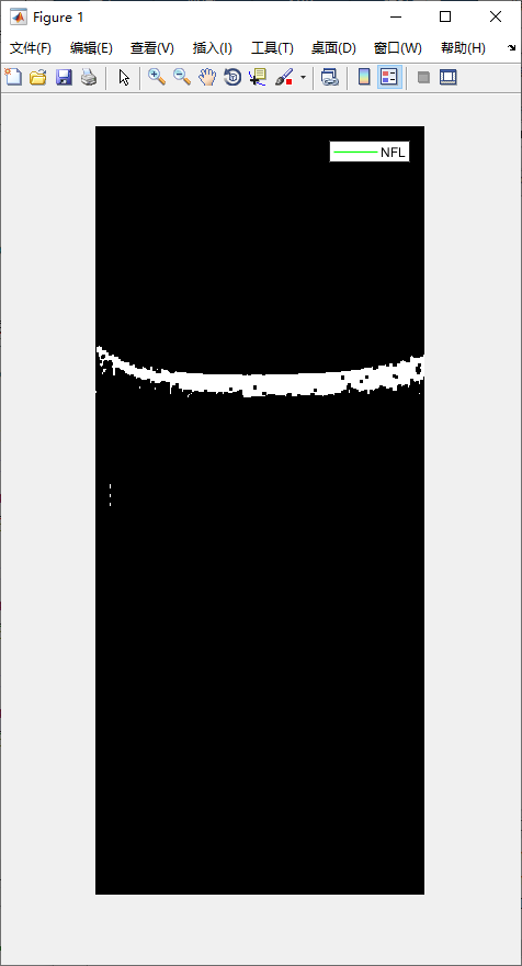 retina-image-segmentation-13.png