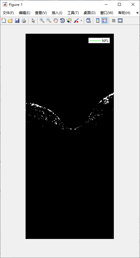 retina-image-segmentation-14.png