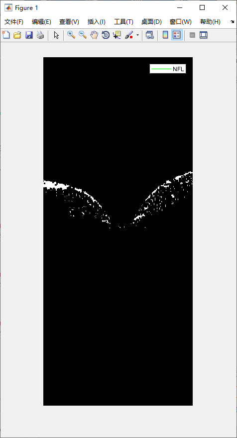 retina-image-segmentation-15.png