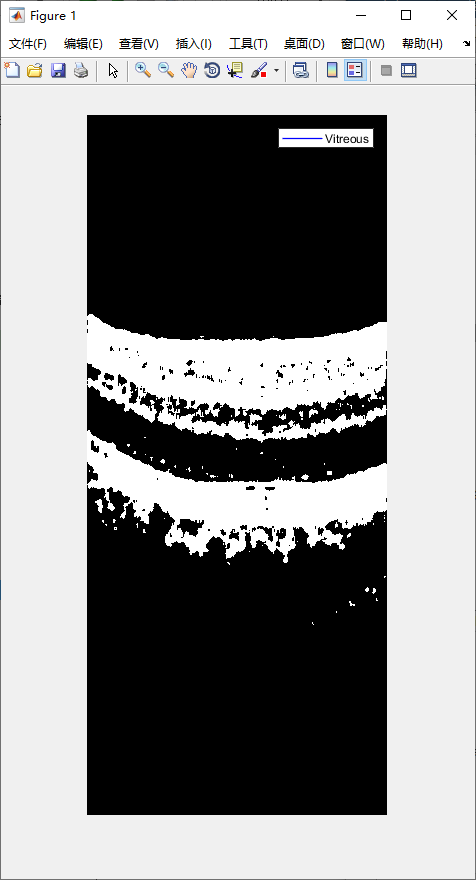 retina-image-segmentation-2.png