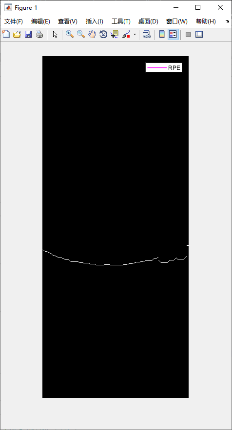retina-image-segmentation-26.png