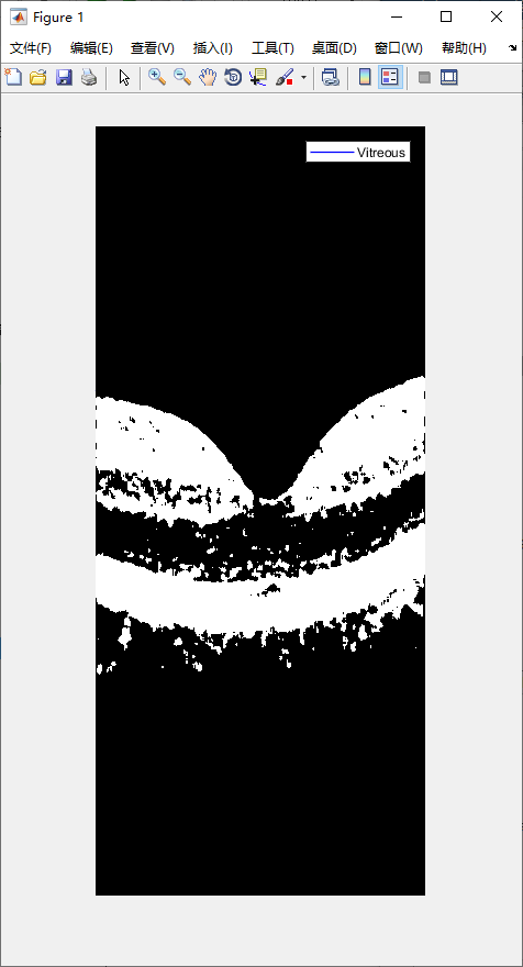 retina-image-segmentation-4.png
