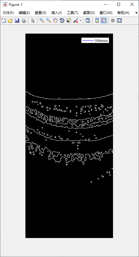 retina-image-segmentation-5.png