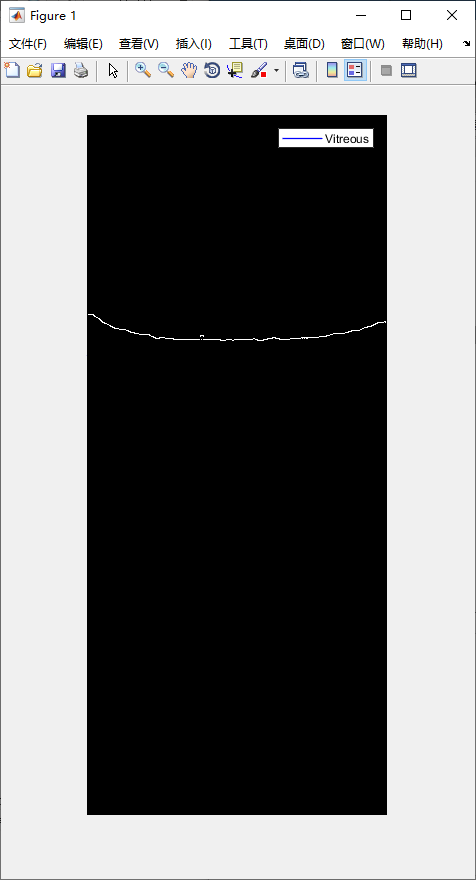 retina-image-segmentation-6.png