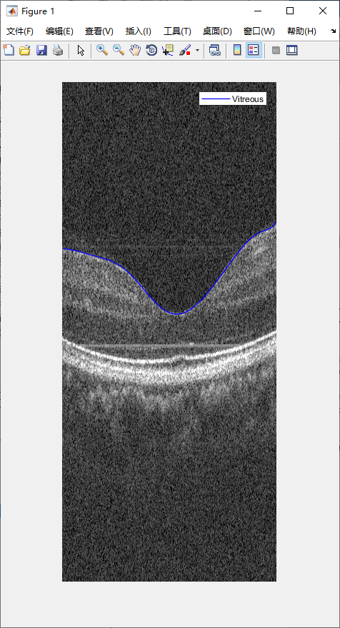 retina-image-segmentation-8.png